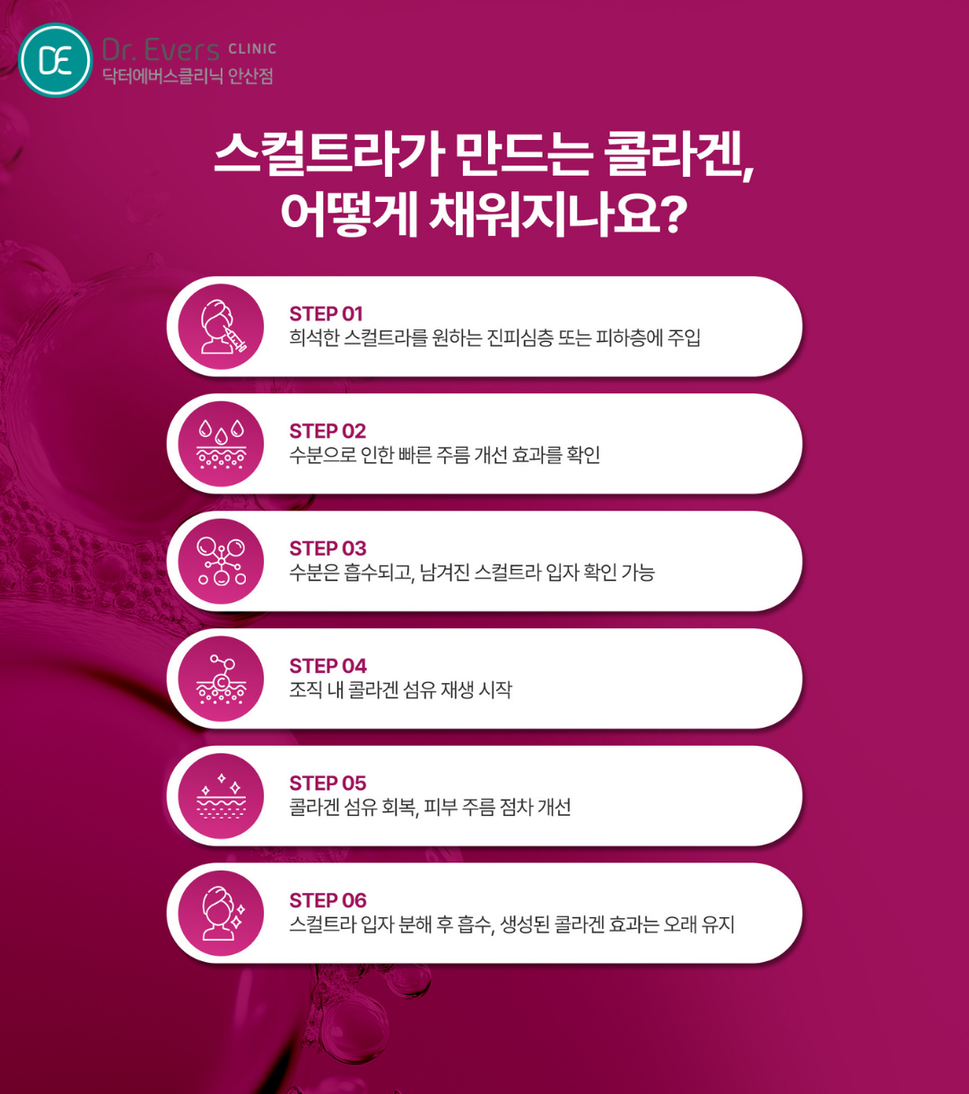 스컬트라 땅콩형 얼굴 볼패임 개선 효과표_닥터에버스의원 안산점