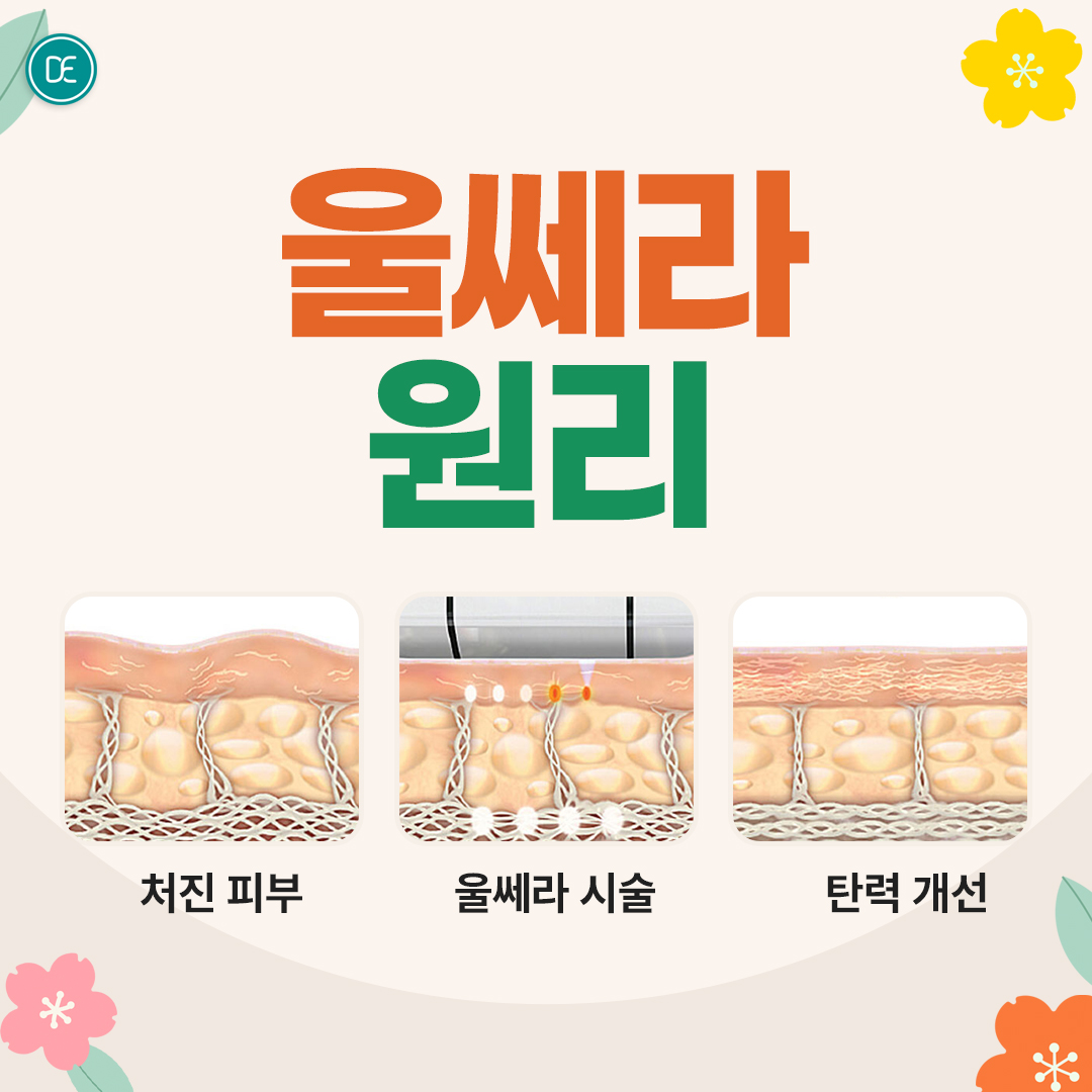 울쎄라 안산피부과 닥터에버스