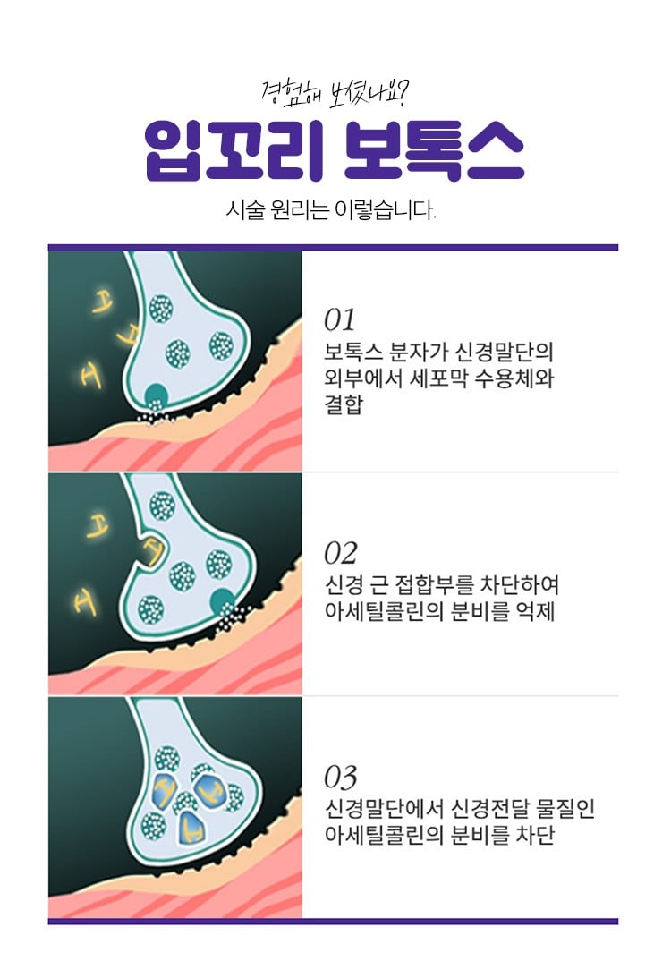 입꼬리보톡스 안산피부과 닥터에버스