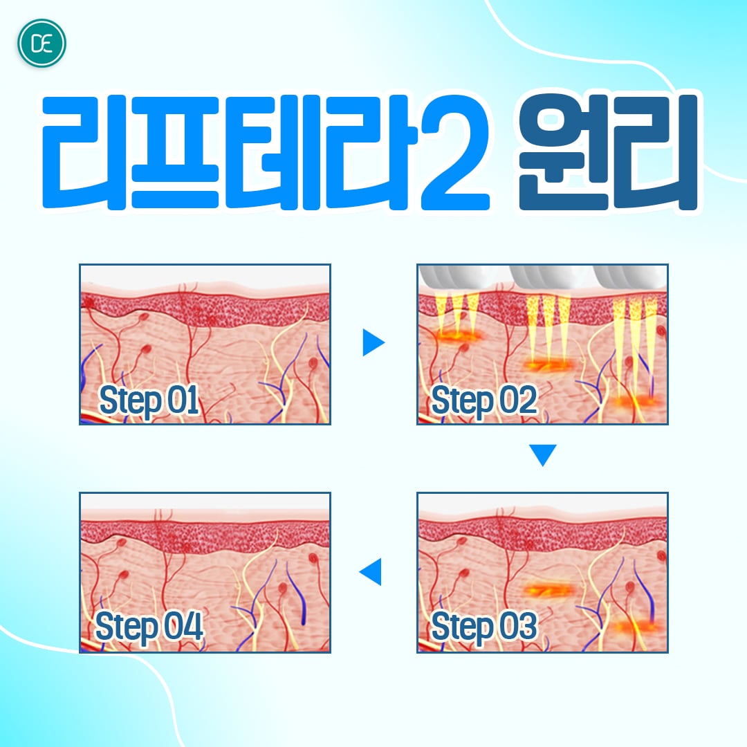 리프테라2 안산피부과 닥터에버스