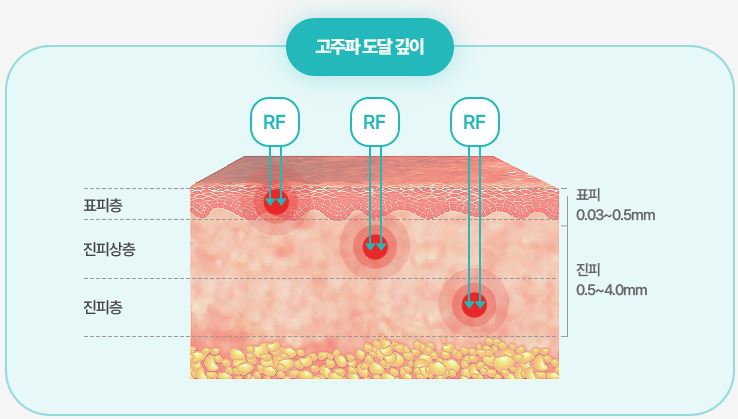 포텐자 안산피부과 닥터에버스