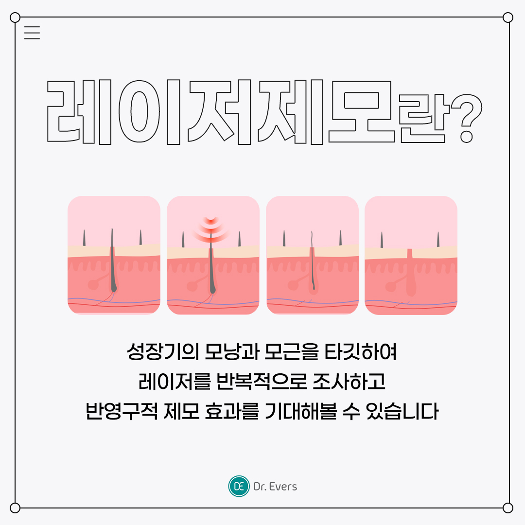 인중 레이저제모 안산피부과 닥터에버스